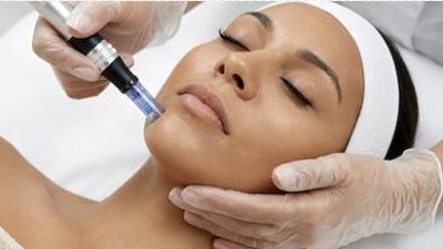Microdermabrasion Microdermabrasion